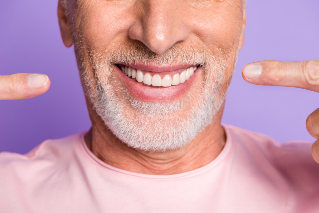 What Are the Benefits of Dental Veneers_