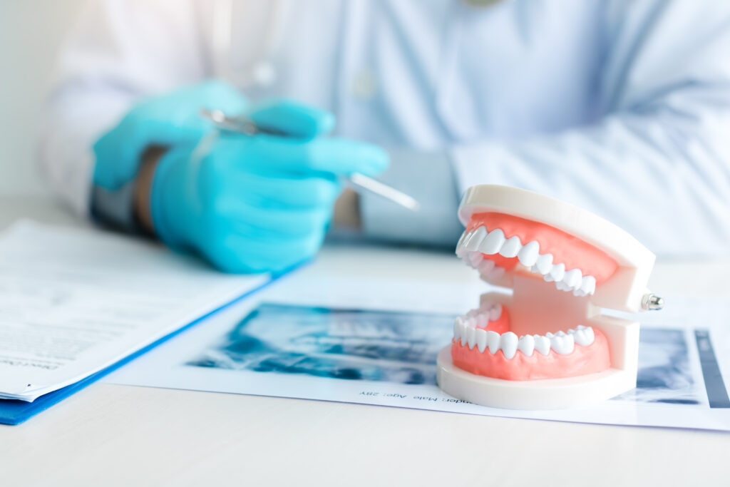 What Should I Expect When Getting Dentures?